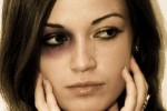 Photoshop: Black Eye