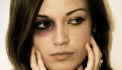 Photoshop: Black Eye